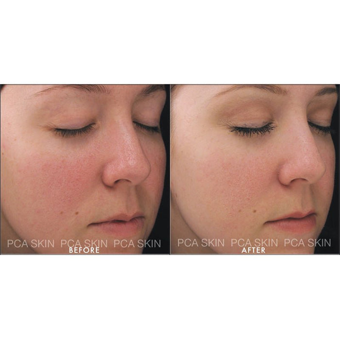 PCA Skincare skincare PCA Skin Dual Action Redness Relief Serum